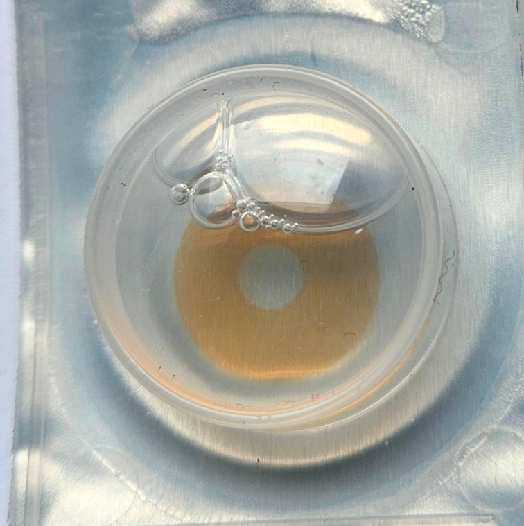 Starlens Supra AMBER pupilliavaga sph -3,0 ja -2,0